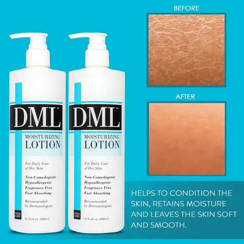 Vista 2 de DML Loción hidratante, hidratante de manos y cuerpo, loción corporal hipoalergénica para piel seca y agrietada, loción hidratante suave y sin
