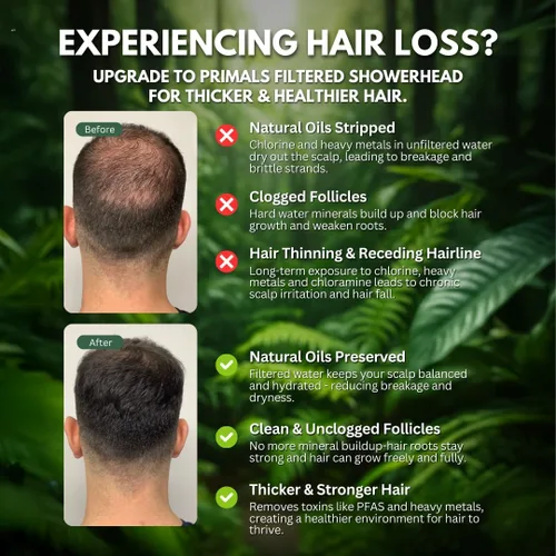 Vista 8 de PRIMALS Cartucho de repuesto para filtro de ducha, reduce la picazón seca, la caspa, el eccema y la pérdida de cabello, elimina el cloro, el flúor