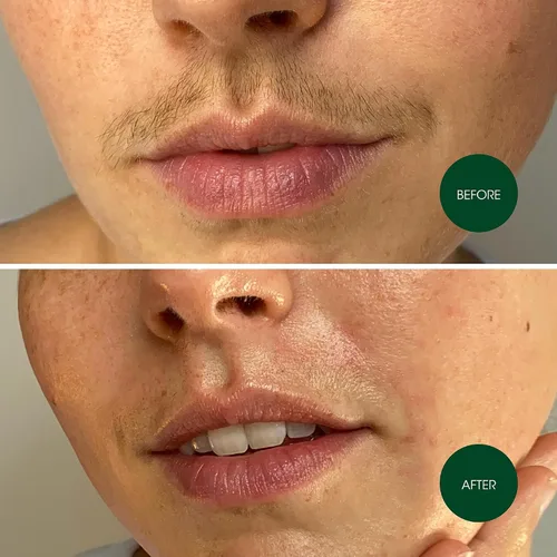 Vista 5 de Nad's Tiras de cera facial, hipoalergénicas para todo tipo de piel, depilación facial para mujeres, kit de depilación en casa con 20 tiras de cera