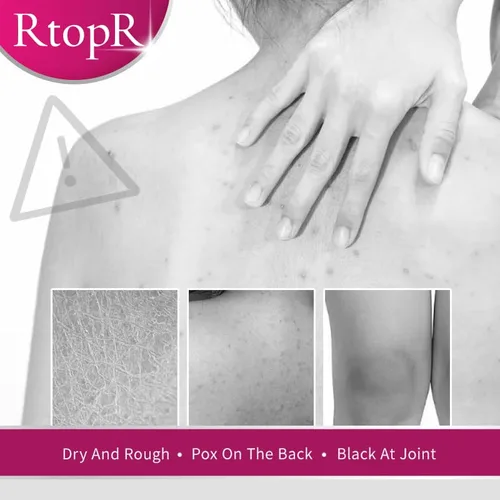 Vista 2 de RtopR Exfoliante facial, exfoliante de nuez para suavizar la cutícula, limpieza profunda, suave y delicada, piel brillante, todo