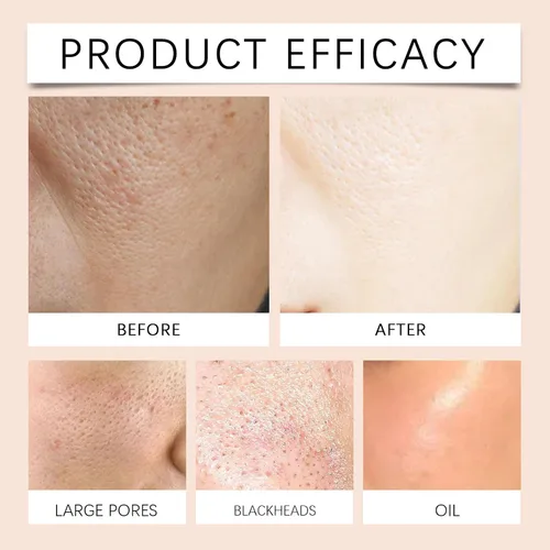 Vista 5 de Gel exfoliante para rostro y cuerpo, limpiador facial suave, gel natural para exfoliar, exfoliante facial de limpieza profunda, exfoliante