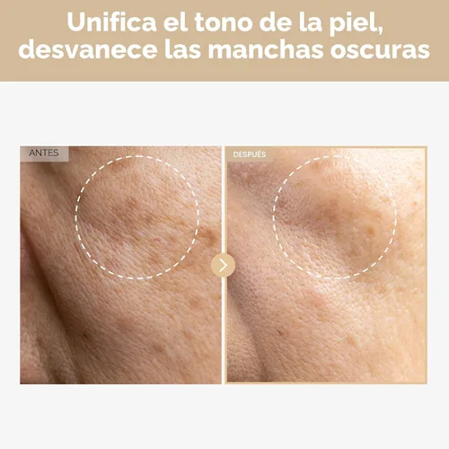 Vista 2 de TOSOWOONG Rice Glow - Tónico lechoso con 784,000 ppm de agua de arroz coreano, niacinamida, ceramidas, pantenol, brillo, piel de vidrio, hidratante
