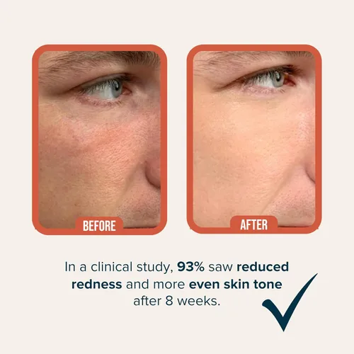 Vista 5 de Cardon Hidratante facial antienvejecimiento para hombres Loción facial coreana para el cuidado de la piel Gel Hydro Boost Extracto de cactus