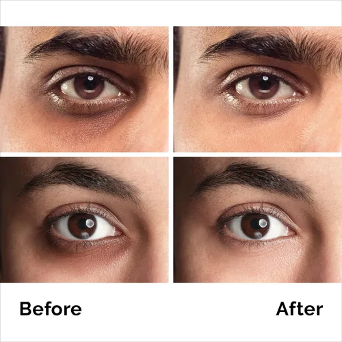 Vista 5 de Crema de ojos con cafeína para antienvejecimiento, ojeras, bolsas, hinchazón. Gran piel debajo de los ojos + estiramiento facial, tratamiento