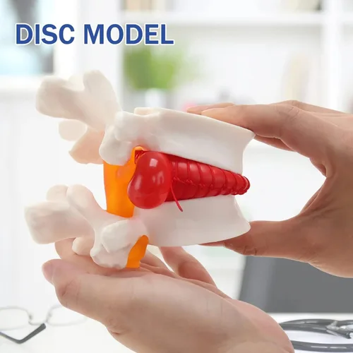 Vista 6 de Modelo de hernia de disco lumbar anatómica humana - Modelo de columna lumbar para enseñar y aprender, modelo de hernia de disco lumbar