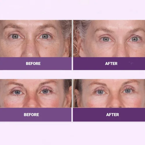Vista 5 de INSTA-TOX - Suero reafirmante facial suavizante de arrugas y crema reafirmante para ojos, tensor para líneas, poros, piel flácida, elevación
