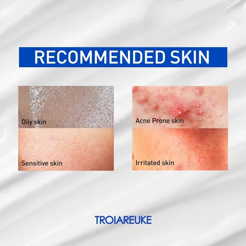 Vista 5 de TROIAREUKE ACSEN Crema de recuperación Hidratante facial hidratante y calmante con centella asiática, aceite de oliva y escualano para pieles