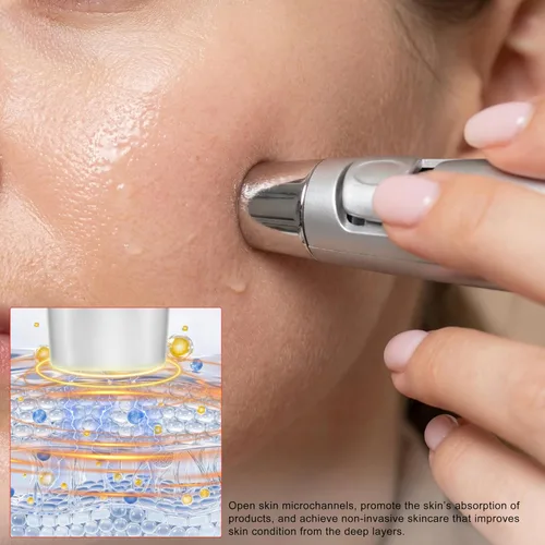 Vista 4 de Elitzia ETF49E Dispositivo facial de electroporación sin aguja, máquina de belleza facial importadora de iones de mesoporación, eliminación