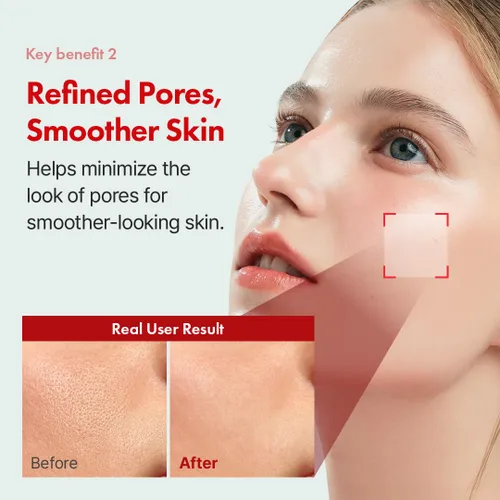 Vista 4 de Hanskin Suero facial de retinol puro 0.1% para cara, reduce las líneas finas y arrugas, signos de envejecimiento para el día y la noche, suavizante