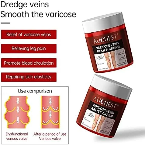 Vista 3 de AUQUEST 2.82 oz Pies Varices Crema Tratamiento Aliviar Capilares Dilatados Eliminación Flebitis Araña Pierna Venas Varices Crema