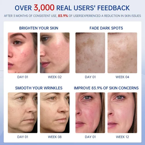 Vista 4 de Suero facial 2 en 1, vitamina C y suero facial de retinol, juego de cuidado de la piel antienvejecimiento con ácido hialurónico, niacinamida