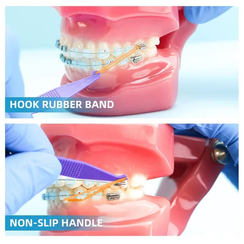 Vista 6 de Annhua Bandas elásticas de ortodoncia, 500 unidades (3.5 onzas, 1/4 pulgadas), bandas de tracción de goma dental, bandas para huecos dentales, aseo