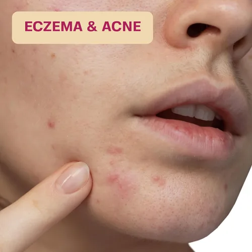Vista 4 de BASE LABORATORIES Toallitas de ácido hipocloroso para rostro y piel – Limpieza facial y reparación diaria de la piel Toallitas de ácido hipocloroso