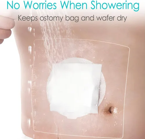 Vista 2 de Ostomy - Funda de ducha impermeable para bolsa de ostomía, protector de ducha, protector de ducha, colostomía, bolsas de baño, vendaje adhesivo