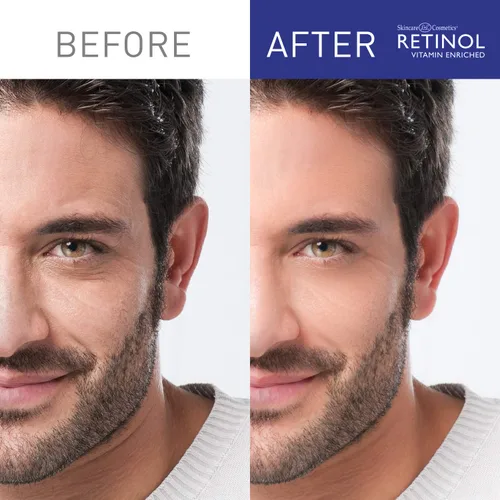Vista 2 de Retinol Set de regalo para hombre: incluye crema hidratante diaria, crema para ojos, suero facial, limpiador de gel y removedor de puntos negros