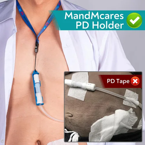 Vista 2 de Soporte patentado de transferencia de diálisis peritoneal para Baxter, accesorios para cinturón de soporte de catéter PD