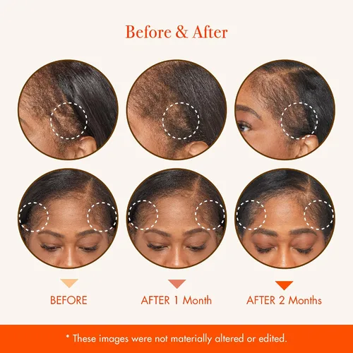 Vista 5 de RED by Kiss Aceite fortalecedor del cabello con aceites orgánicos 100% naturales y certificados por USDA para el crecimiento del cuero cabelludo