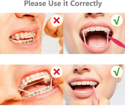 Vista 2 de 100 unidades DentalSmile Amber Elastic Latex Braces 3/16 ortodoncia bandas de goma pesadas 6.5oz bandas de látex dental dentista ideal para rastas