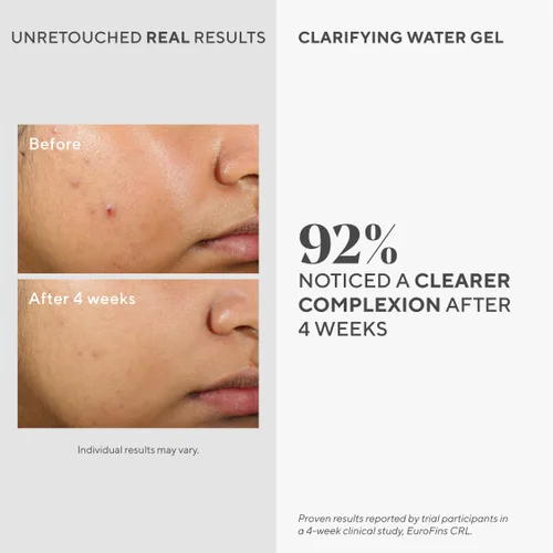 Vista 2 de Murad Gel de agua clarificante, hidratante facial ligero para piel propensa al acné con ácido salicílico e hialurónico para prevención de brotes