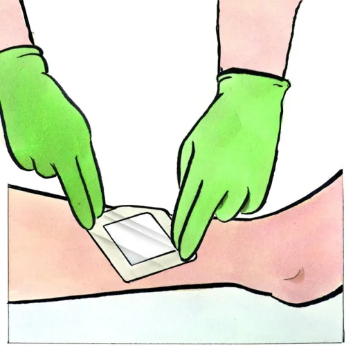 Vista 7 de Medline Stratasorb - Apósitos adhesivos impermeables para heridas, 4 x 4 pulgadas, caja de 10