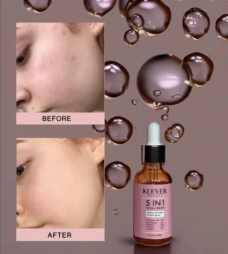 Vista 4 de Suero facial antienvejecimiento con ácido hialurónico, vitamina C, colágeno, niacinamida y vitamina E - Tratamiento facial hidratante para todo tipo