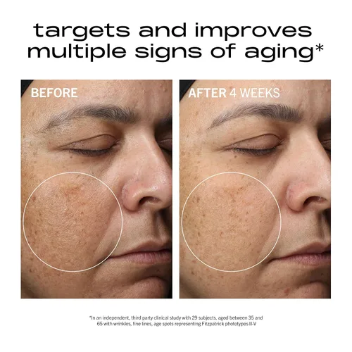 Vista 5 de MATTER OF FACT Concentrado antiarrugas y textura, suero antienvejecimiento para el cuidado de la piel con retinol y vitamina C para una piel más