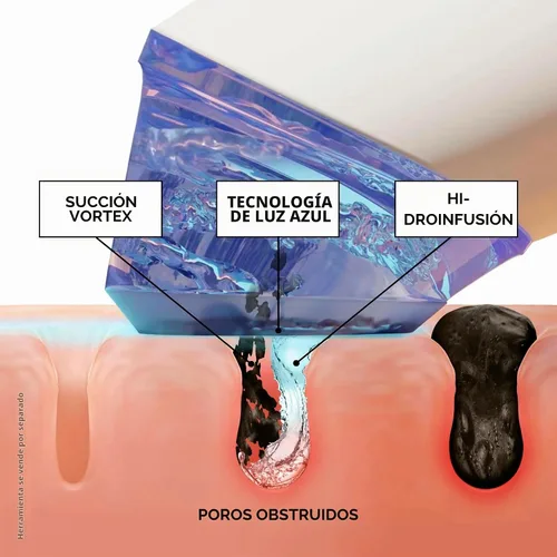 Vista 5 de BeautyBio GLOfacial Hydro-Infusion Deep Pore Cleansing + Blue LED Clarifying Set: Tool + Concentrate
