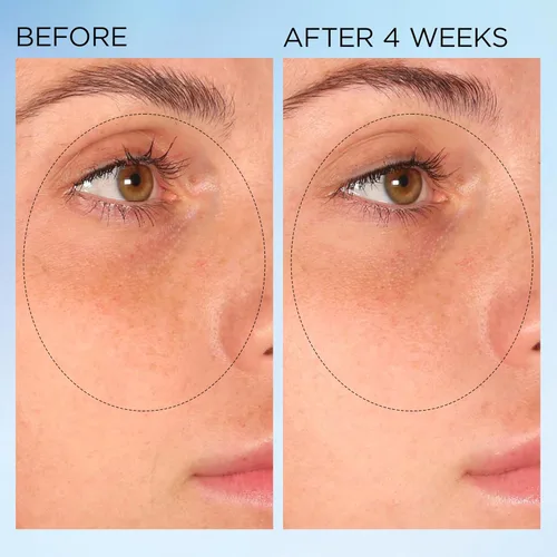 Vista 7 de Elizabeth Arden Cápsulas nocturnas de corrección de manchas claramente radiantes que iluminan visiblemente