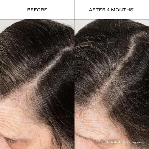 Vista 4 de Zenagen Suero engrosante para el cabello
