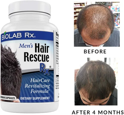 Vista 7 de Hair Rescue Rx - Suplemento para adelgazar el cabello para hombre con biotina y ortiga, soporta un cabello más grueso y saludable, soporte