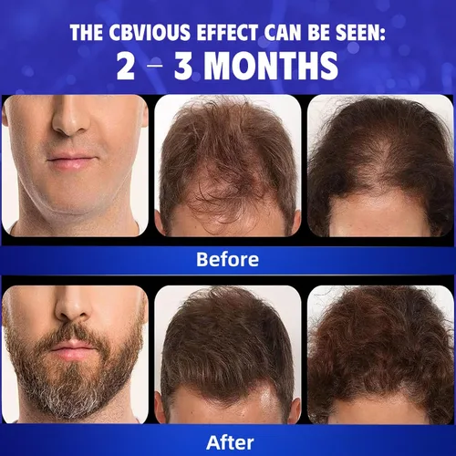 Vista 2 de Blue Sea Sky 5% Minoxidil Tratamiento de Regreso del Cabello 4 x 2 fl oz Azul-Gris