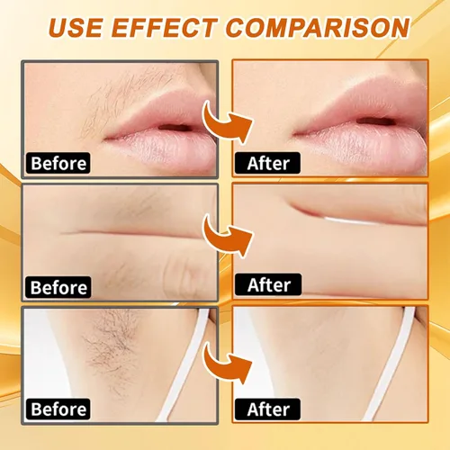 Vista 3 de Joy Pretty - Removedor de vello facial para piel sensible, Joy Cream depilación facial para mujeres, crema de depilación facial suave para mujeres