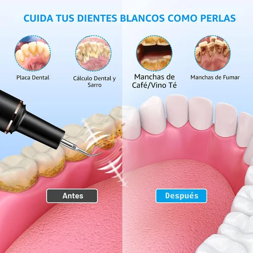 Vista 2 de Kit de limpieza de dientes, removedor de placa para dientes, herramienta portátil para quitar placa dental con LED, blasador de placa para dientes