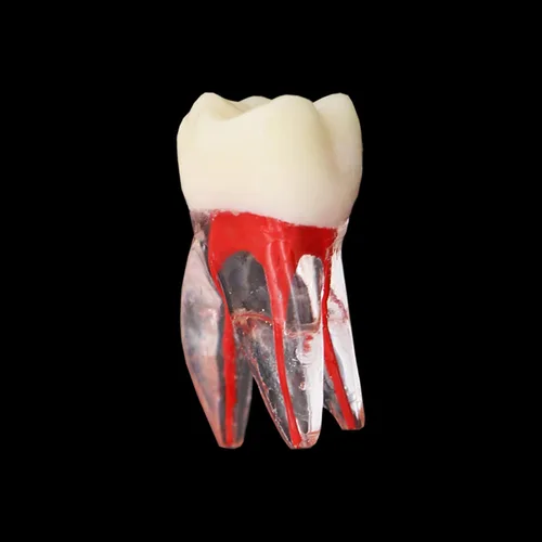 Vista 4 de 10 unids dientes modelo endodoncia archivo práctica pulpa para enseñanza estudio M807 16 #