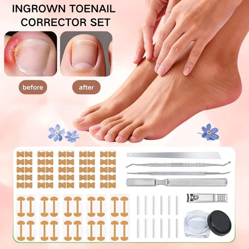 Vista 6 de Juego de corrector de uñas encarnadas con tiras correctoras, juego de herramientas profesionales de pedicura para uñas encarnadas con lima