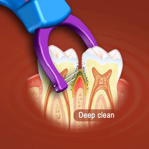 Vista 4 de T.Smile Evolutionary Clean - Kit de recambios de hilo dental más mango largo (1 mango + 100 recambios)