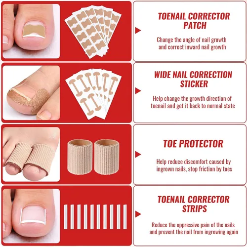 Vista 5 de Kit de eliminación de uñas encarnadas, kit de herramientas de uñas encarnadas con corrector de uñas encarnadas, gotas de uñas encarnadas, parche