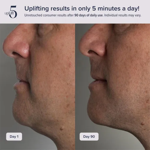 Vista 4 de Elevación facial pulsante Dispositivo de reversión de edad de 5 minutos, contornea y mejora las estructuras faciales, tensando y tonificando