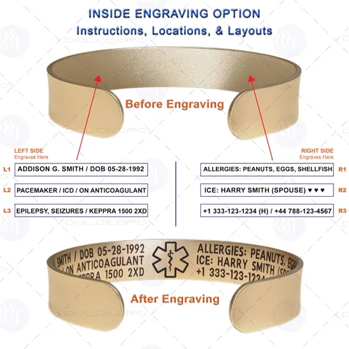 Vista 14 de Pulsera de identificación de alerta médica, acero inoxidable 316L, personaliza y personaliza, selecciona un tamaño de muñeca, de 6 a 9 pulgadas