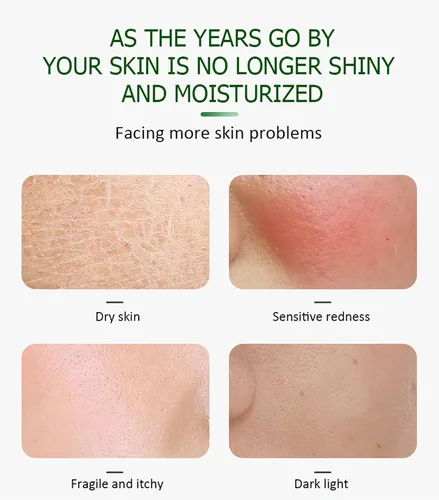 Vista 4 de AICHUN BEAUTY Suero facial calma hidratante Anti-acné reparación Cuidado de la piel facial 1.0 fl oz