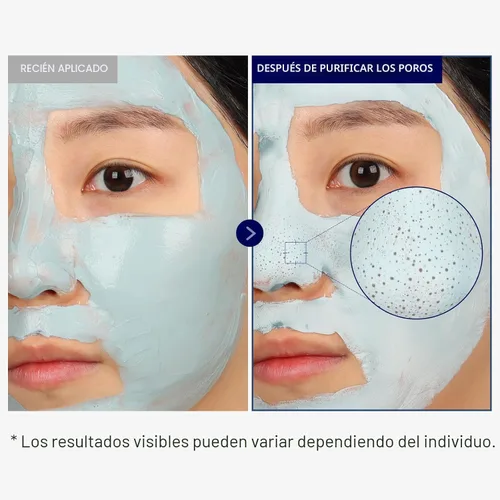 Vista 3 de TOSOWOONG Máscara de barro de puntos negros, arcilla purificadora de poros faciales y nasales – Máscara de barro coreana, ajuste de poros, limpiador