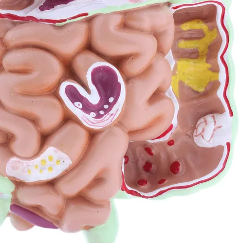 Vista 4 de KESOTO Modelo de Patología Gastrointestinal Humana Modelo Coronal Gástrico del Tracto Digestivo para Estudiantes Escolares Aprendizaje