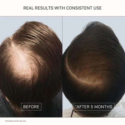 Vista 5 de ACTIIV Recover - Tratamiento de champú engrosante para hombres Apoya la apariencia de un cabello más completo y de aspecto más saludable, apoya