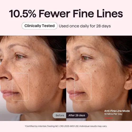 Vista 4 de Wavytalk Máscara de terapia de luz roja para cara, ELLE mejor herramienta Rosa
