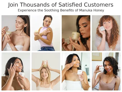 Vista 5 de Blossom Essentials Crema de miel, reparación de hidratación para piel seca y con picazón, alivio de eccema y psoriasis para pieles sensibles, miel