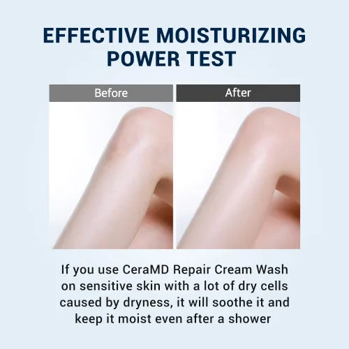 Vista 4 de Derma B CeraMD - Jabón en crema reparadora, sin perfume, limpiador facial y corporal cremoso para pieles secas y sensibles con picazón, gel de baño
