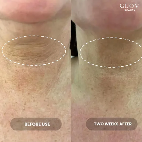 Vista 2 de Glov Beauty - Crema para el cuello Lift & Firm - Crema antienvejecimiento para cuello y escote para arrugas, flacidez de la piel y estiramiento