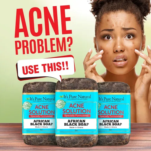 Vista 6 de It's Pure Natural Barras de jabón africanas negras con solución para el acné (paquete de 3) jabón orgánico crudo para cara y cuerpo, tratamiento