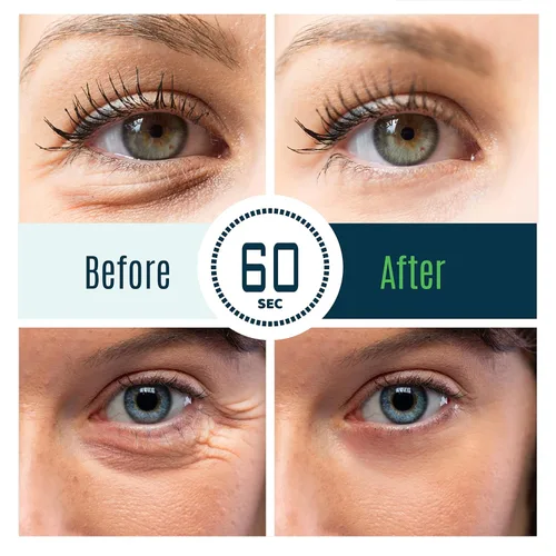 Vista 8 de Tratamiento de ojos hinchados Time Reverse Instant Anti-aging Eye Cream Nueva fórmula avanzada - Reduce visiblemente las bolsas debajo de los ojos