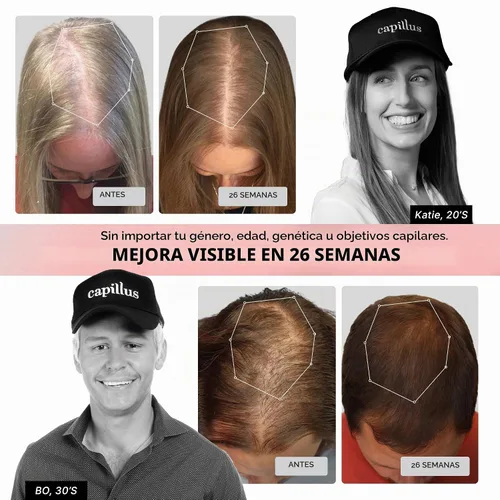 Vista 2 de Capillus Pro S1 - Gorra láser para terapia de luz roja, para el crecimiento